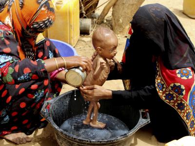 A severely malnourished infant is bathed in a bucket Aug. 25, 2018 in Yemen's Hajjah province